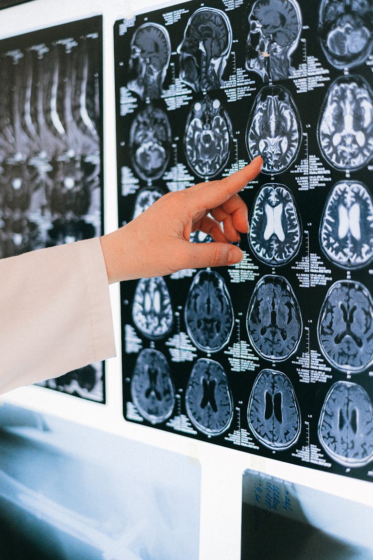 research in ayahuasca and neruroplasticity
